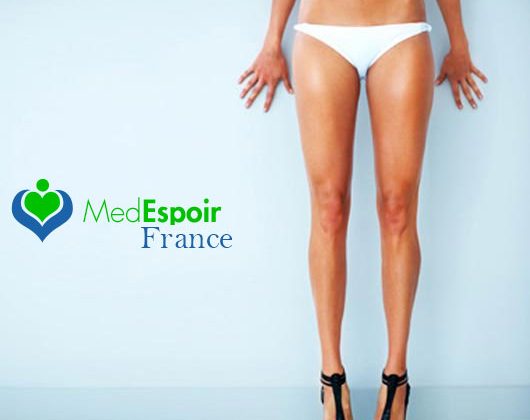 Tout savoir sur les incisons du lifting des cuisses Tout savoir sur les incisons du lifting des cuisses
