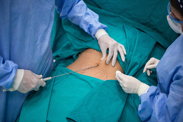 liposuccion ventre Tunisie