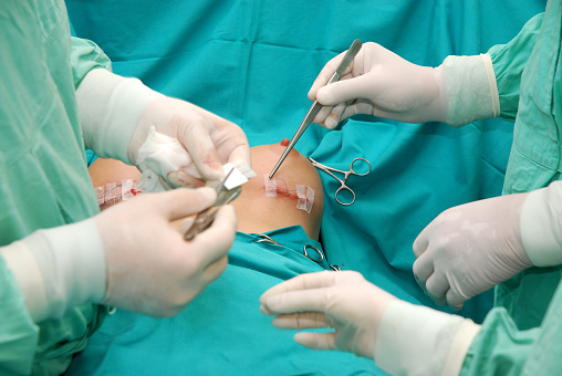 chirurgien-tunisie-augmentation-mammaire