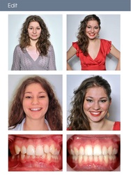  Des Implants Haut de Gamme Pour Retrouver Un Sourire Impeccable