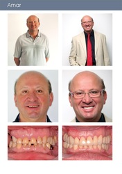  Suppression des caries et blanchement des dents par laser.