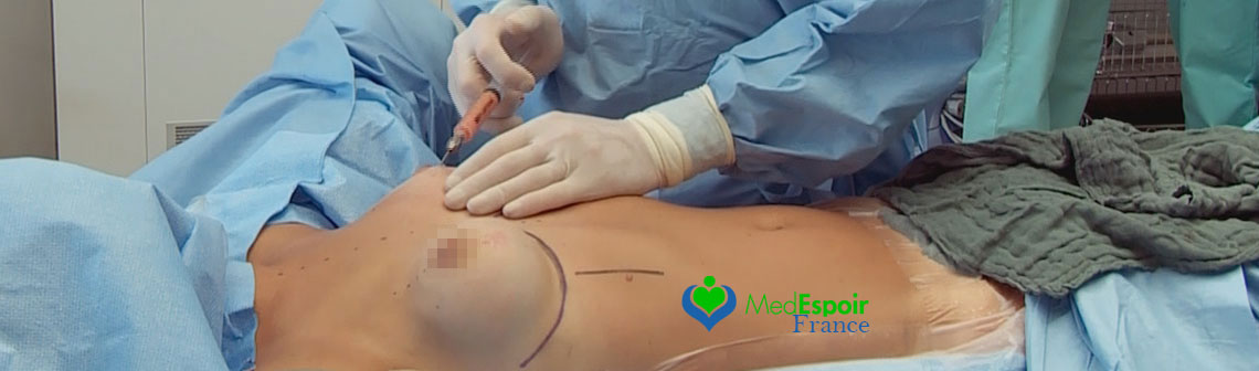 cirugía mamaria en Túnez