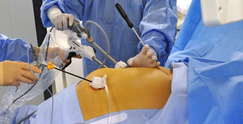 Le rôle de la chirurgie bariatrique dans la réduction du risque cardiovasculaire Le rôle de la chirurgie bariatrique dans la réduction du risque cardiovasculaire