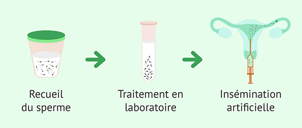 insemination-artificielle-tunisie