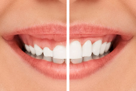 Prix penoplastie Prix penoplastie
