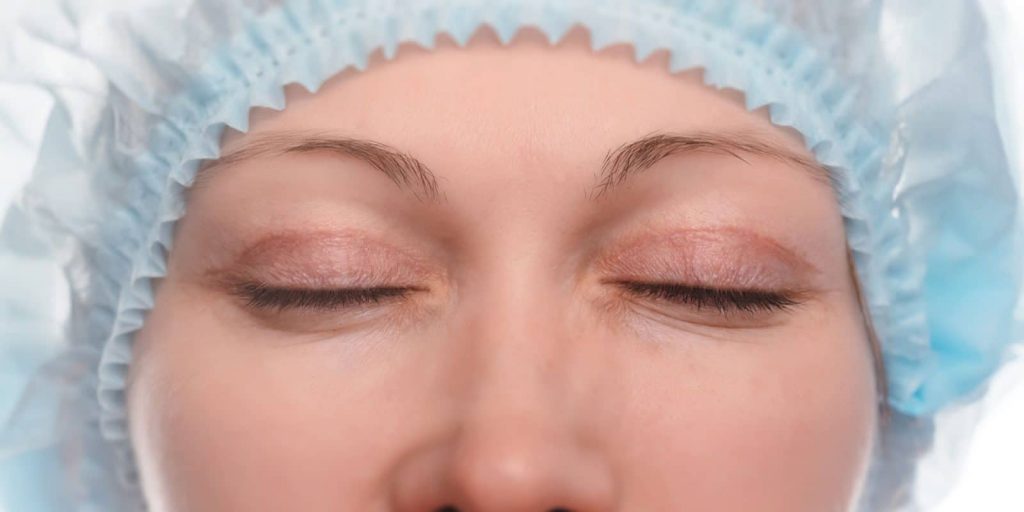 chirurgie-esthetique-blepharoplastie