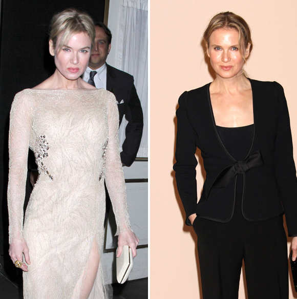 Renée Zellweger avant apres