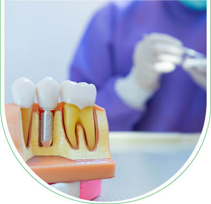 Implante dental Túnez