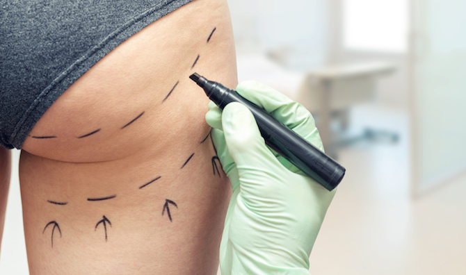 tendances de chirurgie esthétique