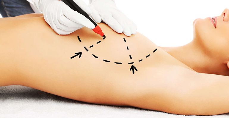 augmentation mammaire Paris