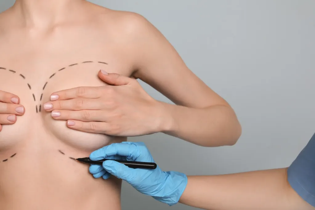 chirurgie esthetique des seins en Lyon