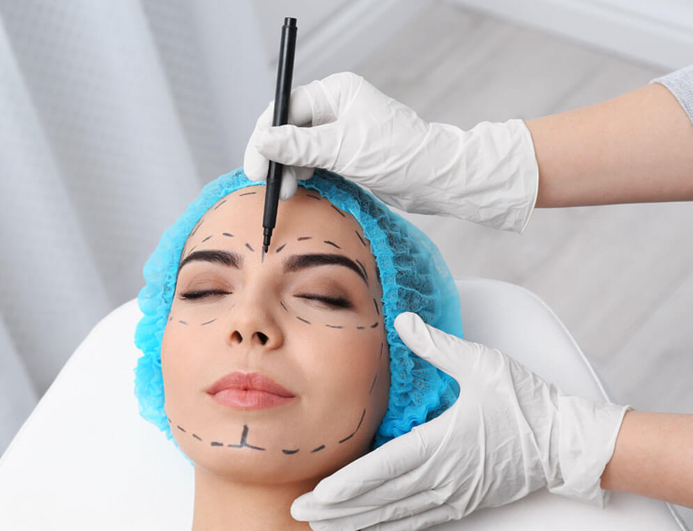 chirurgie esthetique visage Lyon
