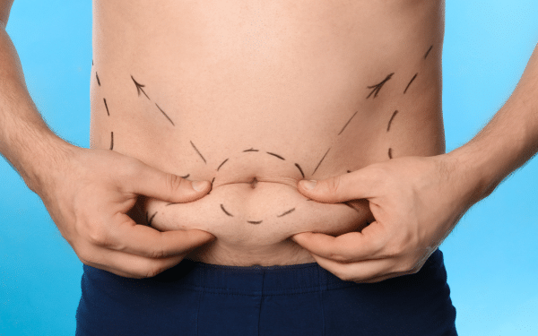 Liposuccion VASER ou WAL