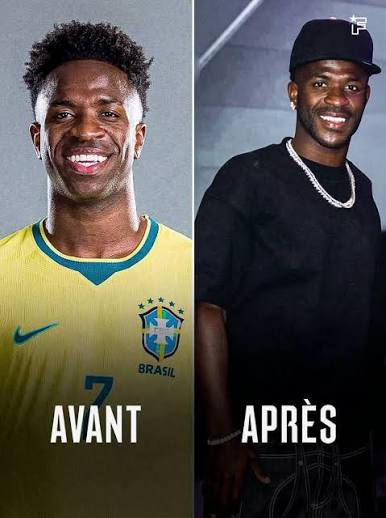 Vinícius Júnior chirurgie esthétique