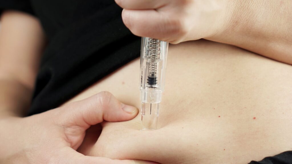 chirurgie combinée Après Ozempic ou Mounjaro